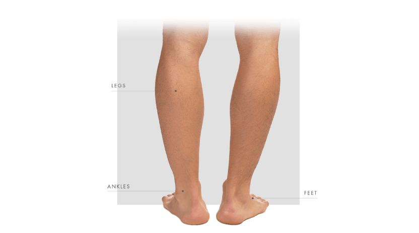 Treatable areas of legs, ankles, feet