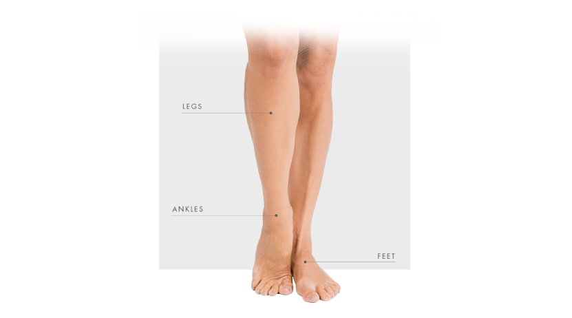 Treatable areas of legs, ankles, feet